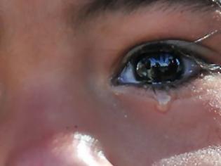 Φωτογραφία για Το κορίτσι που έχει σαστίσει την επιστημονική κοινότητα - Αντί για δάκρυα «κλαίει» πέτρες