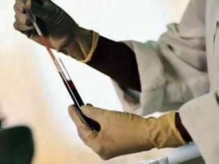 Φωτογραφία για Ο ιός της γρίπης χτύπησε τη Δυτική Ελλάδα - Νοσηλεύεται στη ΜΕΘ 38χρονος