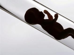 Φωτογραφία για ΗΠΑ: Ιστορικό υψηλό των γεννήσεων με εξωσωματική γονιμοποίηση