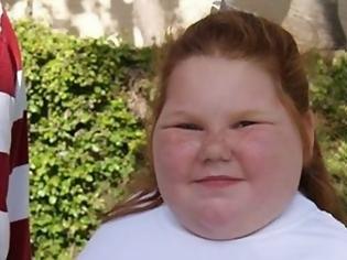 Φωτογραφία για Η 12χρονη που ζυγίζει 92 κιλά - Μία σπάνια ασθένεια είναι η αιτία που παχαίνει χωρίς σταματημό [photos]