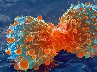 Φωτογραφία για ΑΠΟΚΑΛΥΨΗ ΒΟΜΒΑ: Ο καρκίνος είναι ένας μύκητας και είναι ιάσιμος!