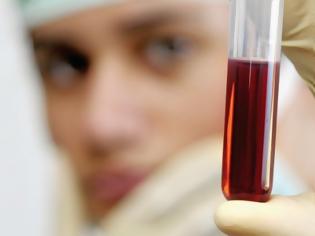 Φωτογραφία για Ένα νέο βελτιωμένο τεστ αίματος-DNA ανιχνεύει τον καρκίνο