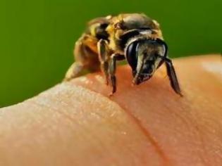 Φωτογραφία για Πότε ένα τσίμπημα μέλισσας γίνεται επικίνδυνο;