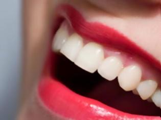 Φωτογραφία για Χαμογελάστε για να δει ο γιατρός αν πάσχετε από σοβαρή ασθένεια - Τα 4 προβλήματα υγείας που φαίνονται από τα δόντια