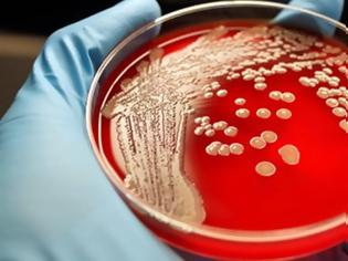 Φωτογραφία για Παγκόσμια απειλή: Τα σούπερ μικρόβια βγάζουν άχρηστα τα αντιβιοτικά