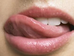Φωτογραφία για Βγάζετε περίεργα σημάδια στη γλώσσα; Πέντε προβλήματα υγείας που φαίνονται από το στόμα