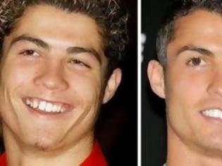 Φωτογραφία για ΔΕΙΤΕ: Διάσημοι σταρ πριν και μετά τον οδοντίατρο