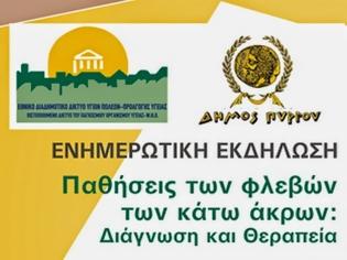 Φωτογραφία για Παθήσεις των Φλεβών των Κάτω Άκρων