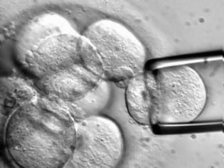 Φωτογραφία για Ελπιδοφόρο νέο! Ανθρώπινα εμβρυϊκά βλαστοκύτταρα θεράπευσαν επιτυχώς τη σκλήρυνση κατά πλάκας σε ποντίκια