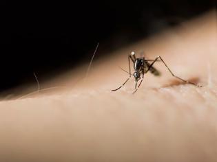 Φωτογραφία για OMG: Δείτε πως πρήστηκαν τα πόδια της από το τσίμπημα ενός κουνουπιού [photos]