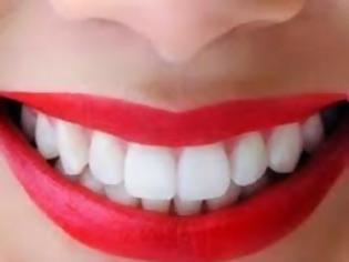 Φωτογραφία για Ποιες τροφές λευκαίνουν τα δόντια;