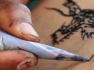 Φωτογραφία για Δείτε τι έπαθε 12χρονη από τατουάζ χένας στη Κρήτη [photos]