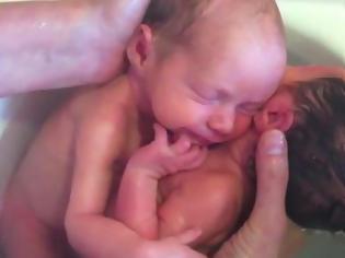 Φωτογραφία για Μοναδικές εικόνες από νεογέννητα μωρά λίγα λεπτά αφού γεννήθηκαν