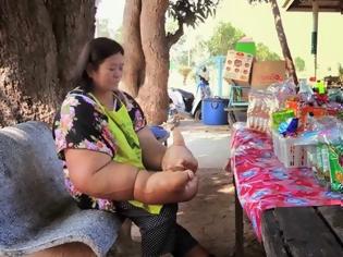 Φωτογραφία για Ταϊλάνδη: Κάθε χέρι της ζυγίζει 10 κιλά (βίντεο)