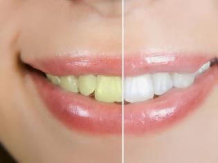 Φωτογραφία για Τέσσερις φυσικοί τρόποι για πιο λευκά δόντια...