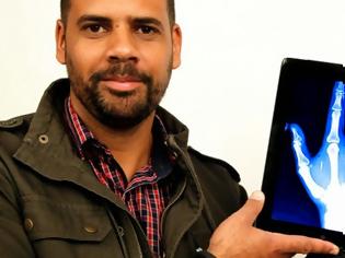 Φωτογραφία για Αυστραλός εμφυτεύει στο χέρι του ένα μικροτσίπ NFC