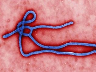 Φωτογραφία για ΠΑΝΙΚΟΣ στις ΗΠΑ! Βρέθηκε ασθενής που έχει προσβληθεί από τον θανατηφόρο ιό Έμπολα