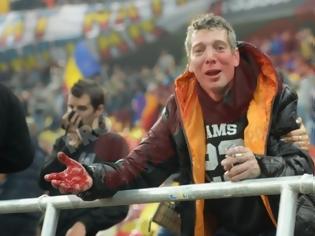 Φωτογραφία για Χάος στο Βουκουρέστι: Σοβαρά επεισόδια μεταξύ οπαδών της Ρουμανίας και της Ουγγαρίας... [photos]