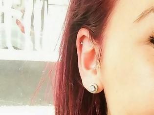 Φωτογραφία για ΣΟΚΑΡΙΣΤΙΚΟ: 18χρονη έχασε μέρος τους αυτιού της χάρη στο... piercing [ΠΡΟΣΟΧΗ ΣΚΛΗΡΕΣ ΕΙΚΟΝΕΣ]