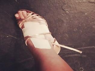 Φωτογραφία για Ακόμα δεν ξεκίνησε τσακίστηκε - Ποια διαγωνιζόμενη του Dancing τραυματίστηκε; [photos]