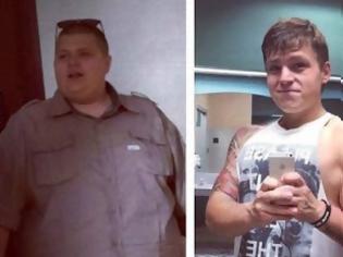 Φωτογραφία για ΣΟΚΑΡΙΣΤΙΚΟ: Ένας 21χρονος έχασε 72 κιλά και το δέρμα του έγινε απίστευτα χαλαρό [photos]