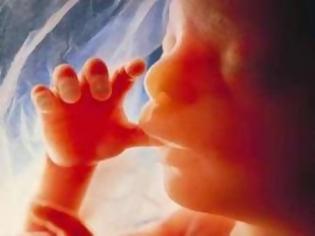 Φωτογραφία για ΣΥΓΚΛΟΝΙΣΤΙΚΟ ΒΙΝΤΕΟ:  H κραυγή απελπισίας ενός εμβρύου... [video]