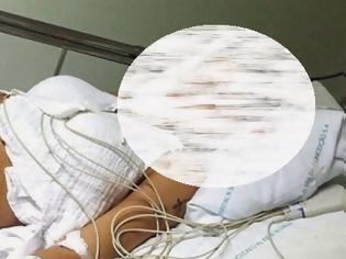 Φωτογραφία για ΠΡΟΣΟΧΗ ΣΚΛΗΡΗ Εικόνα στο νοσοκομείο: Από πλαστική μοντέλο κινδύνευσε να χάσει το πόδι της! [photo]