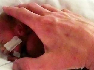 Φωτογραφία για Η ιστορία που ΡΑΓΙΖΕΙ ΚΑΡΔΙΕΣ: Οι γιατροί την πίεζαν τα ρίξει το παιδί της επειδή γεννήθηκε πρόωρα και δεν τους άκουσε...[photos]