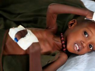 Φωτογραφία για Πεθαίνουν από την πείνα τα παιδιά στη Σομαλία