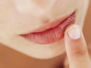 Φωτογραφία για Χείλη που σκάνε το χειμώνα; Πρόλαβέ τα με αυτούς τους 5 τρόπους