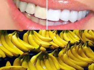 Φωτογραφία για Εντυπωσιακό! Πως θα λευκάνετε τα δόντια σας με μια μπανάνα; [video]