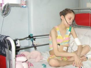 Φωτογραφία για ΣΠΑΡΑΖΕΙ ΚΑΡΔΙΕΣ η 14χρονη που ζητάει να την αφήσουν να πεθάνει...