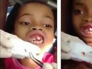Φωτογραφία για Οδοντίατρος δεν πίστευε στα μάτια του με αυτό που είδε στα ούλα 10χρονης... [video]