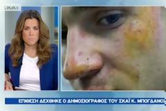Οι δηλώσεις Μπόγδανου για την επίθεση