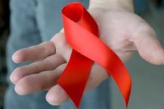 Πότε έγινε γνωστός του ιός του AIDS