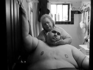 Φωτογραφία για Συγκλονιστικό! Η μακροχρόνια μάχη με την παχυσαρκία και το δραματικό τέλος της ζωής...[photos]