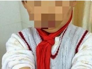 Φωτογραφία για Σοκαριστικές εικόνες - Θετή μητέρα μαστίγωνα 9χρονο επειδή δεν ήξερε την ιστορία του Πινόκιο... [photos]