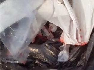 Φωτογραφία για Πάτρα: Νοσοκομειακά απόβλητα με αίματα, σηκώνουν εργαζόμενοι στην καθαριότητα