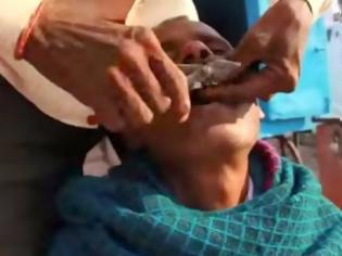 Φωτογραφία για ΦΡΙΚΤΟ: Υπαίθριος οδοντίατρος βγάζει δόντια ασθενών στην Ινδία με την... πένσα [video]