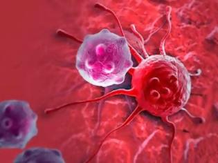 Φωτογραφία για Βρέθηκε το φάρμακο που σκοτώνει τον καρκίνο: Σε 2 εβδομάδες εξαφάνισε 70 θανατηφόρους καρκινικούς όγκους