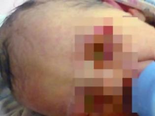 Φωτογραφία για Εικόνες που σοκάρουν: Βρέθηκε νεογέννητο μέσα σε δάσος, σκεπασμένο από έντομα! [photo]