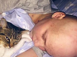 Φωτογραφία για Kατάθεση ψυχής μιας 18χρονης με καρκίνο στο κεφάλι [video+photos]