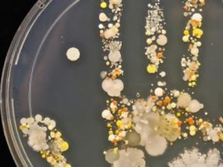 Φωτογραφία για Δείτε πόσα βακτήρια έχει το χέρι του παιδιού σας μετά από μια μέρα παιχνιδιού!