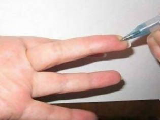 Φωτογραφία για Δείτε το σημείο στο δάχτυλο που μειώνει την πίεση και εξαφανίζει κάθε είδους πόνο