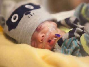 Φωτογραφία για ΚΑΤΑΠΛΗΚΤΙΚΟ ΒΙΝΤΕΟ: Το μωράκι που γεννήθηκε πρόωρα, ζύγιζε μόλις 538 γραμμάρια αλλά τελικά τα κατάφερε [video]