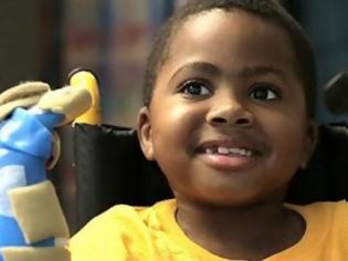 Φωτογραφία για 8χρονος γίνεται το πρώτο παιδί που υποβλήθηκε σε μεταμόσχευση και των δύο χεριών