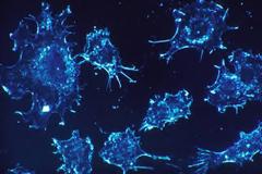 Πρόστιμο σε όσους δεν κάνουν τσεκ απ και προσβληθούν από καρκίνο