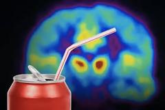 Το υψηλό ζάχαρο βλάπτει τον εγκέφαλο, ακόμα και αν είναι ρυθμισμένο