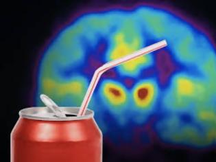 Φωτογραφία για Το υψηλό ζάχαρο βλάπτει τον εγκέφαλο, ακόμα και αν είναι ρυθμισμένο