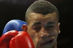 Το ανδρικό πρόσωπο «πλάστηκε από τις γροθιές»...